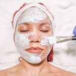 Unlocking Radiant Skin: The Benefits of Chemical Peel Treatments